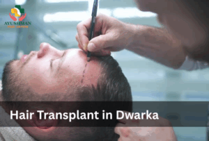 Hair Transplant in Dwarka