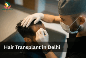 hair transplant in delhi