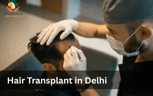 hair transplant in delhi