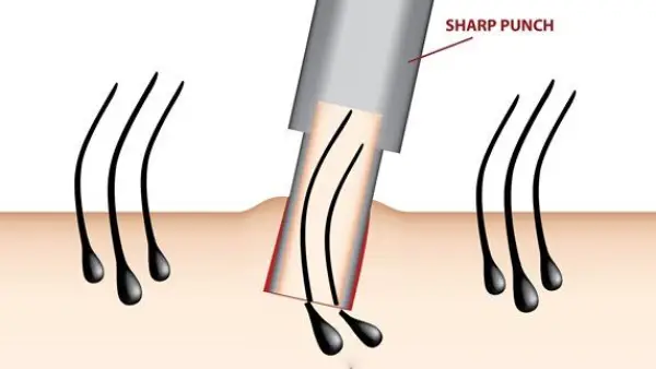 No Root Touch Technology