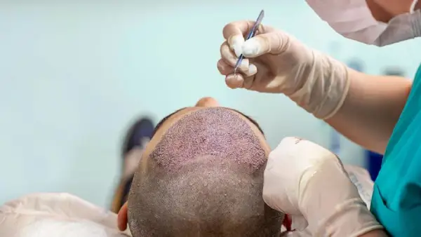 Real Time Extraction and Implantation