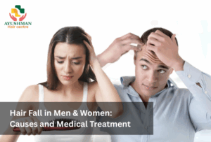 Hair Fall in Men & Women