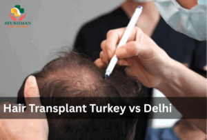 Hair Transplant Turkey vs Delhi