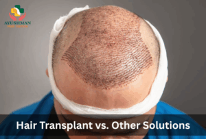 Hair Transplant vs. Other Solutions