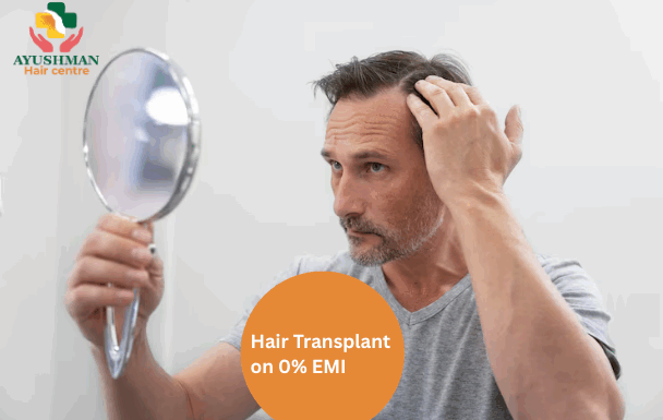 Zero-Cost EMI Hair Transplant in Delhi