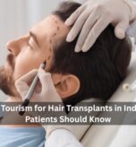 Medical Tourism for Hair Transplants in India What Patients Should Know.jpg